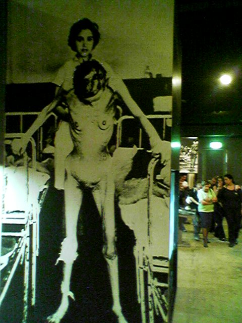 图为在集中营中成为人体试验品的犹太妇女。