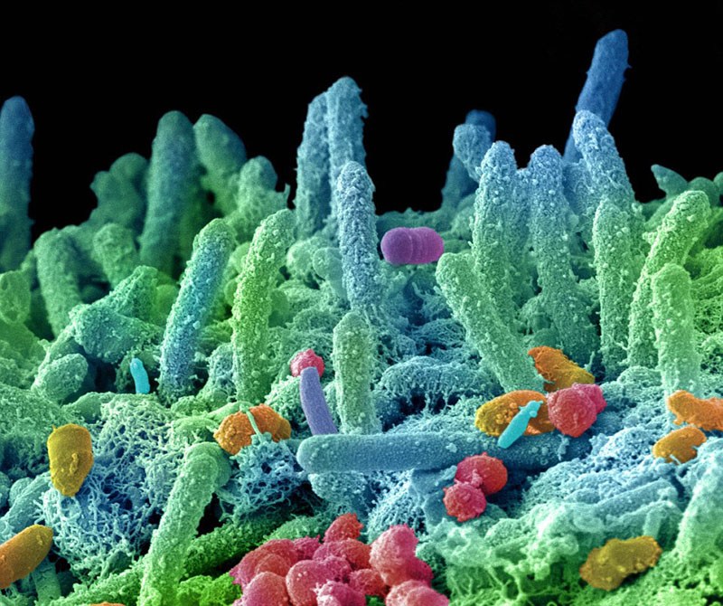 研究发现，有些细菌有益于人体口腔健康，它们能帮助控制有害细菌的数量，维持口腔健康。（来源：环球网）