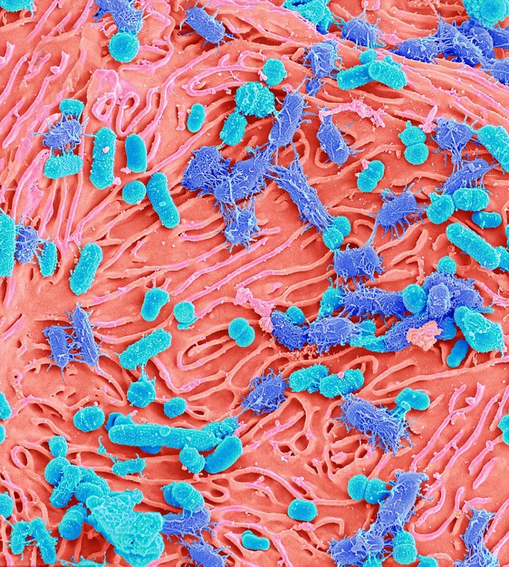 而另一些细菌，如乳酸菌、螺旋体等，则易造成齿龈病、蛀牙等口腔疾病。（来源：环球网）