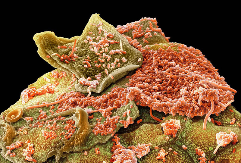 图为口腔细菌。（来源：环球网）