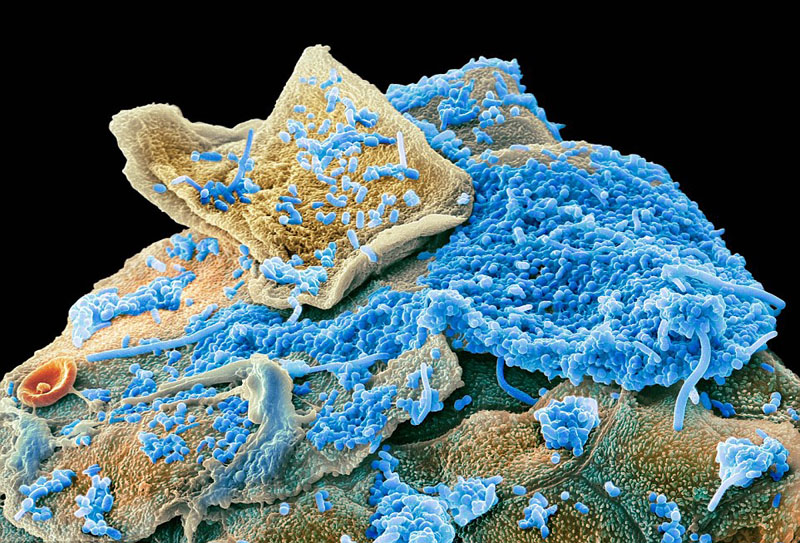 图为口腔细菌。（来源：环球网）