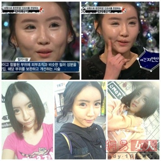 韩国整形中毒女从假人又整回真人了 手机网易网