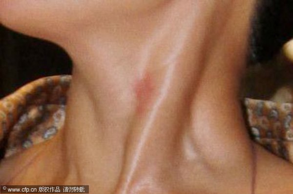 2013年08月12日讯，北京，日前，刘嘉玲出席某活动引大量粉丝围观。当天，刘嘉玲现身后亲切与粉丝打招呼，看向台上时脖颈疑似现出吻痕。